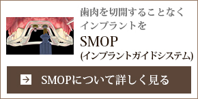 SMOP（インプラントガイドシステム）