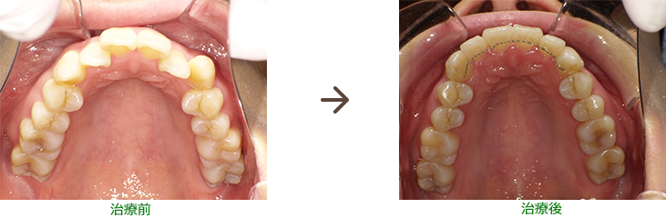 安い・早い・痛くない矯正治療(2)