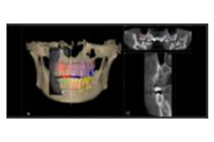 CT撮影によるDICOMデータ（骨の立体画像）